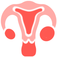 Ovarian Cancer