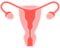 Uterine Fibroids