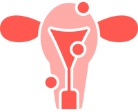 Endometriosis